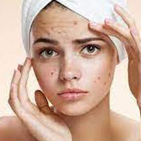  Treatment of all types of skin soriasis diseases.